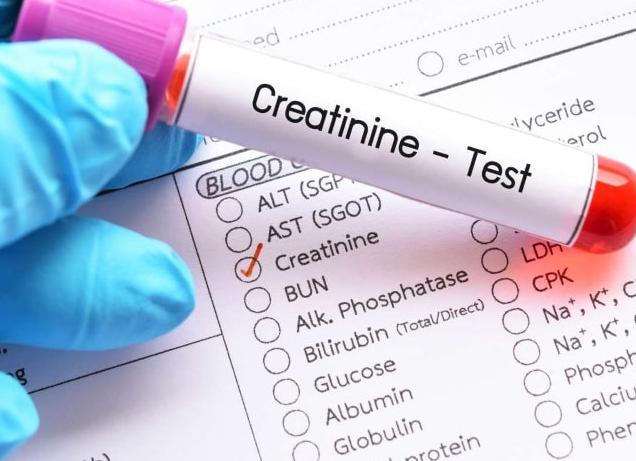 Анализ на креатинин Анализ на креатинин