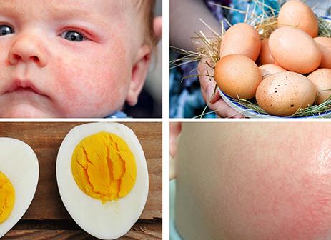 Аллергия на куриный белок у грудничка Аллергия на куриный белок у грудничка