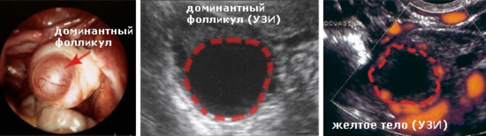 Как по узи определить овуляцию
