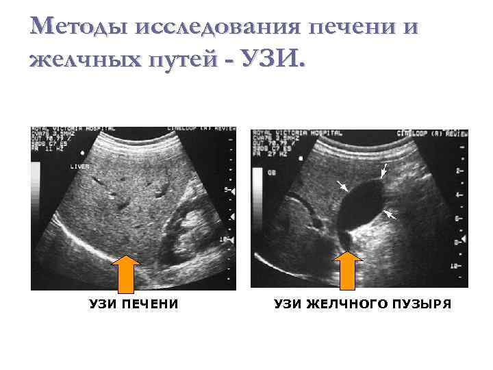 Как подготовиться к узи печени