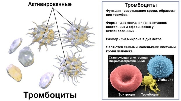 Как понизить уровень тромбоцитов в крови