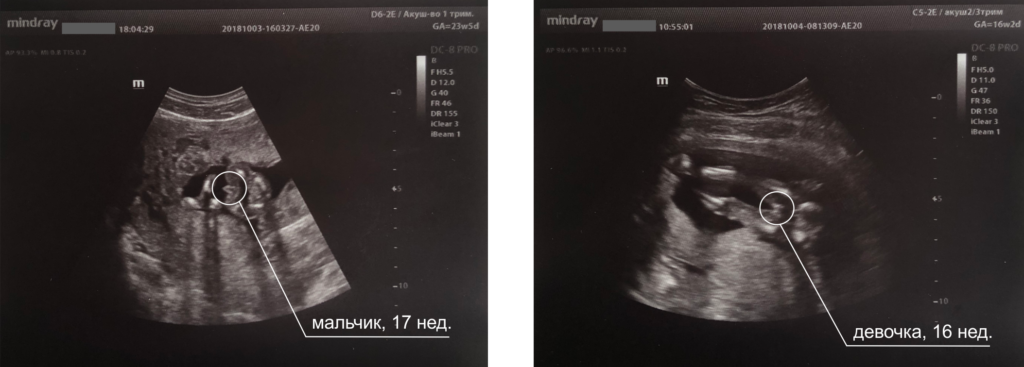 Когда известен пол ребенка