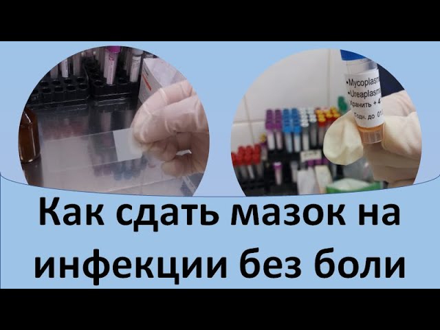 Мазок из уретры больно у мужчин