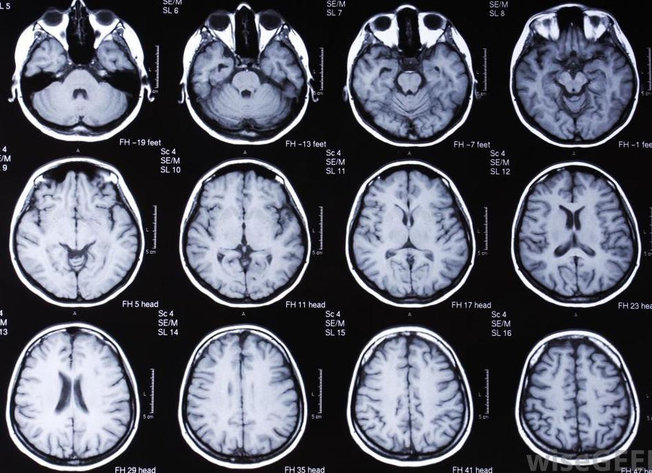 Мрт головы сколько стоит Мрт головы сколько стоит
