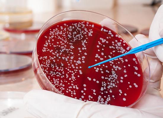 Кровь на стерильность это что