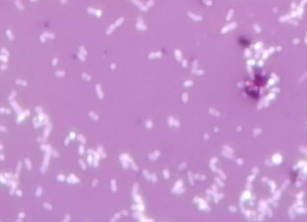 Кокки палочки микрофлора