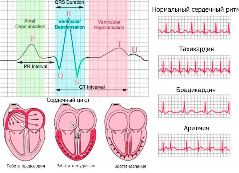 Кардиограмма что показывает