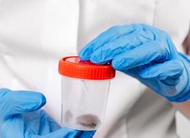 Кал на дисбактериоз как сдавать ребенку