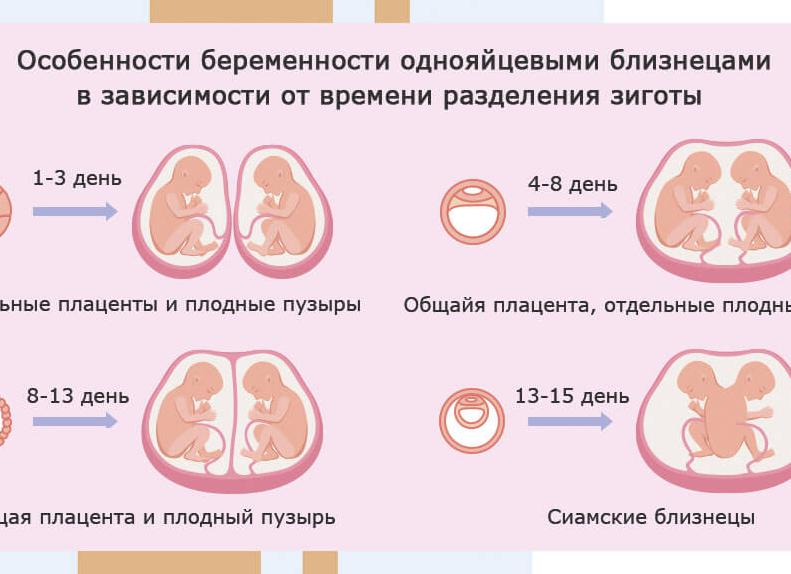 Как определить двойню