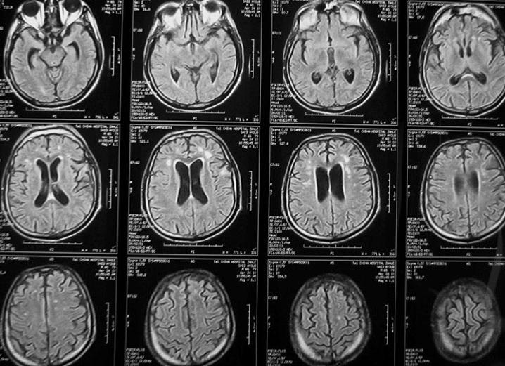 Что такое рэг головного мозга у взрослых