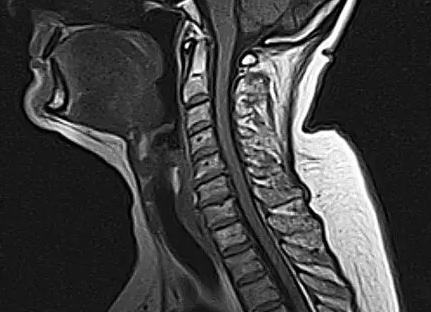 Что показывает мрт уха