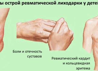 Асл о что это за анализ