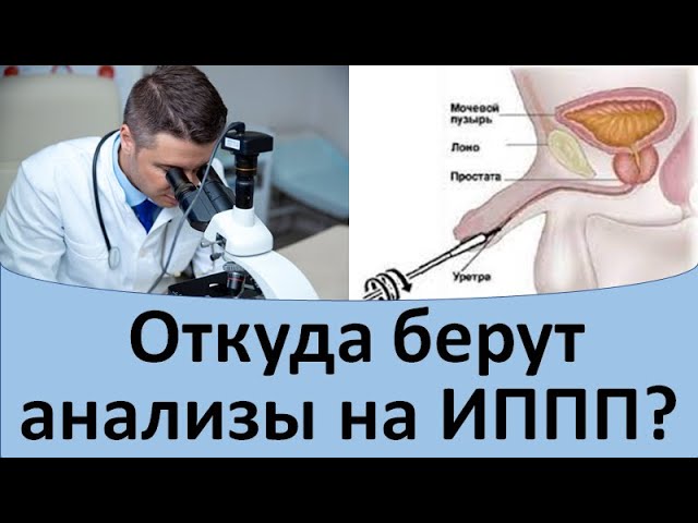 Мазок на зппп у женщин