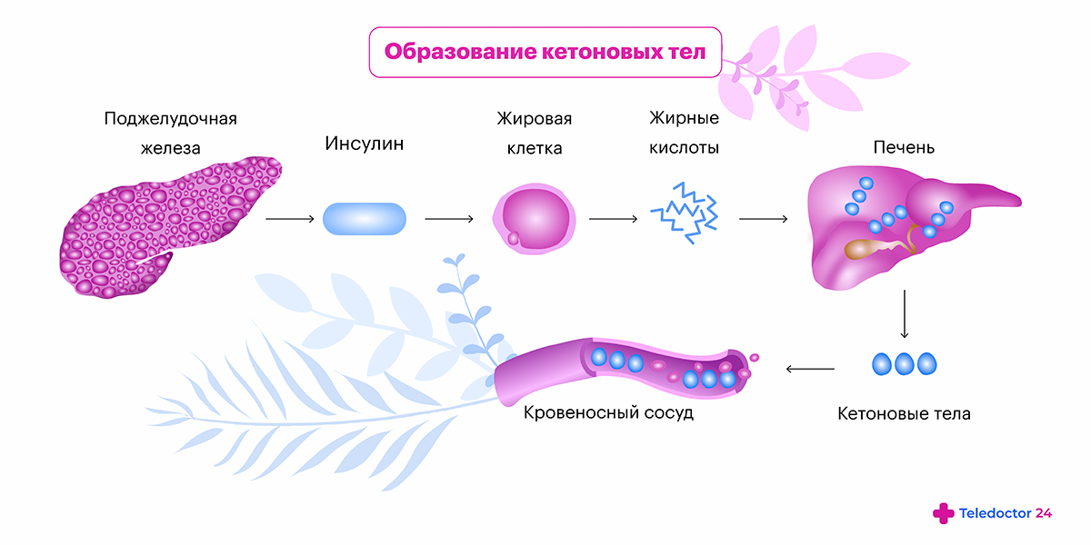 Моча пахнет ацетоном почему