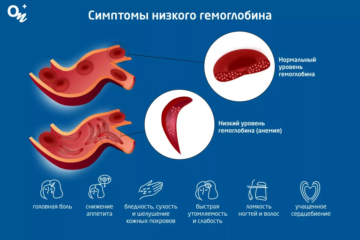 Может ли при низком гемоглобине болеть голова