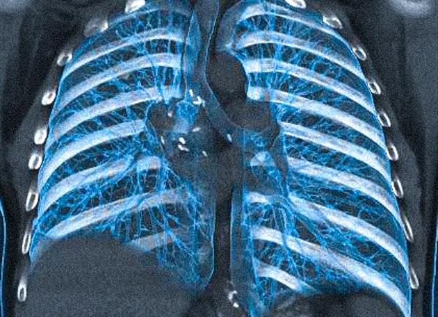 Кт грудной клетки что покажет