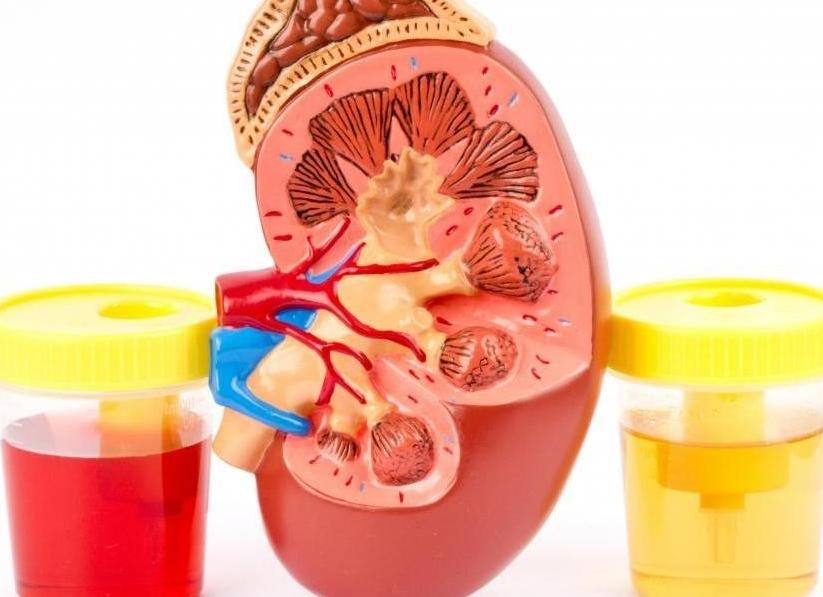 Красная моча у ребенка что это