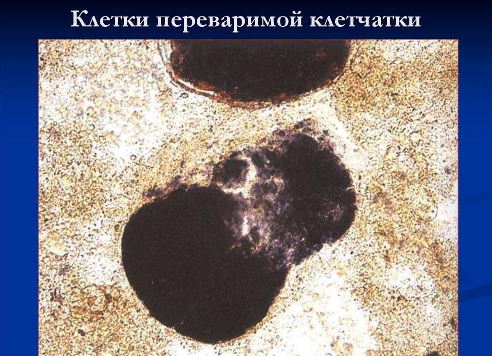 Йодофильные бактерии в кале у взрослого