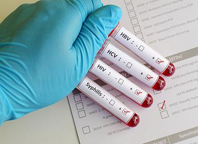 Иппп особенности обследования