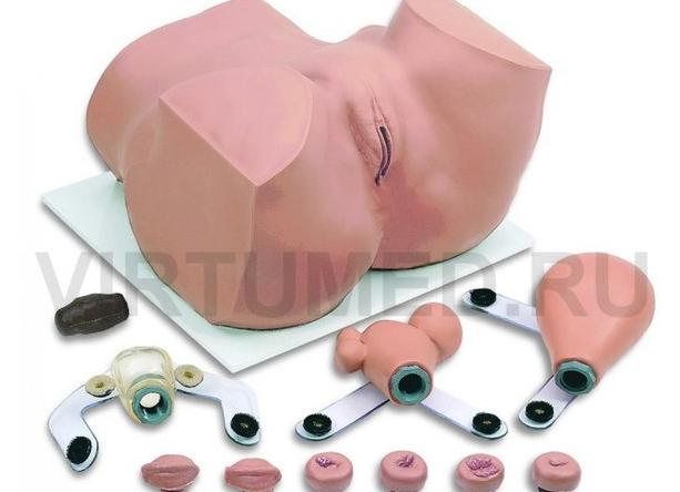 Фтм в гинекологии что это такое