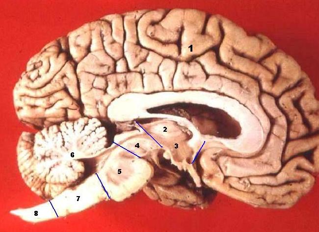 Фото головной мозг