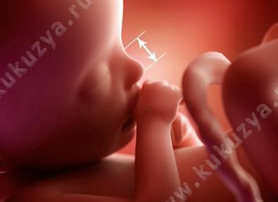 Длина носовой кости