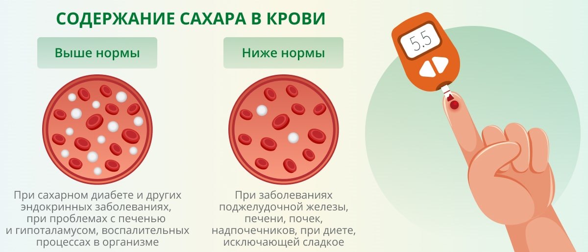 Как сдают кровь на сахар