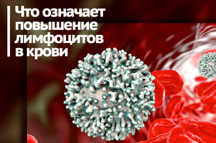 Лимфоциты в анализе крови что это такое