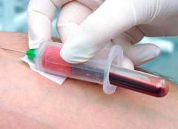 Как подготовиться к сдаче ттг Как подготовиться к сдаче ттг