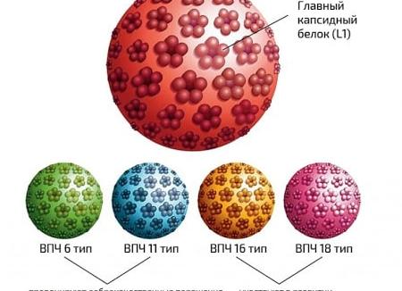 Как лечить папилломы на половых органах