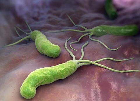 Хеликобактер пилори это