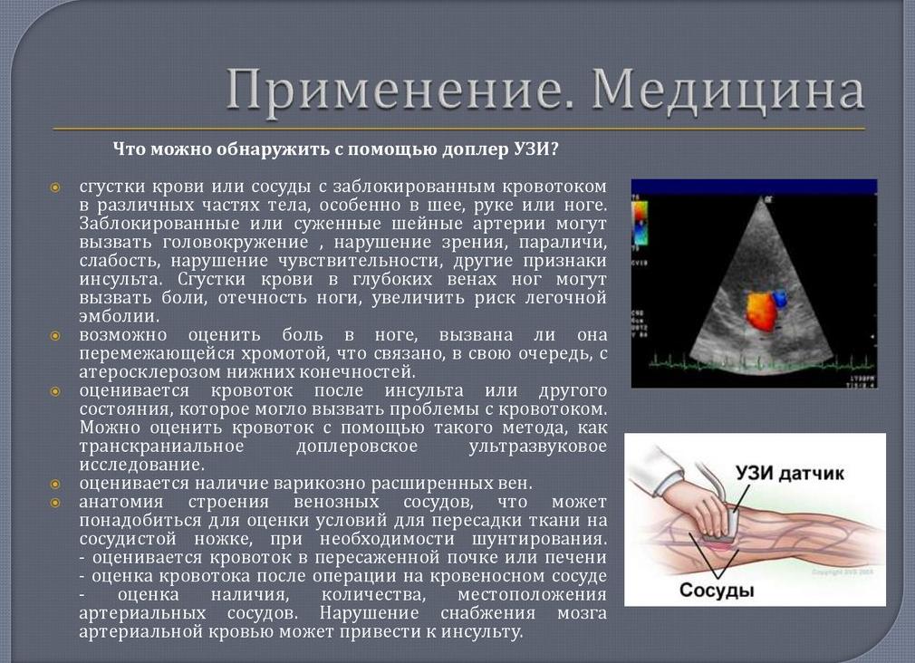 Эффект доплера в медицине