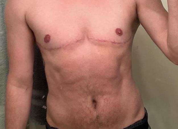 Что происходит в первую неделю после зачатия