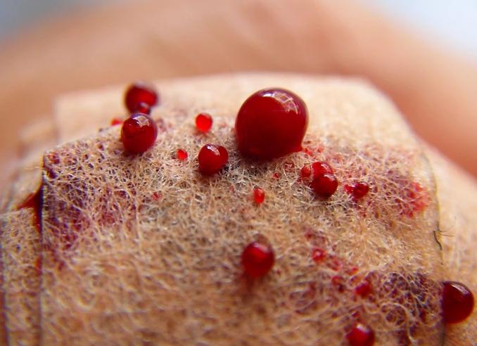 Чем опасна густая кровь