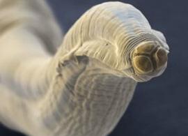 Анализ на токсокароз