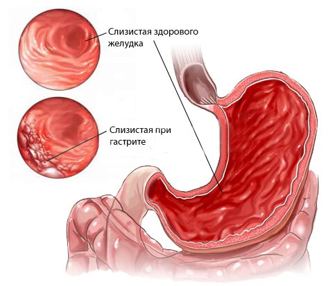 Какашки черного цвета