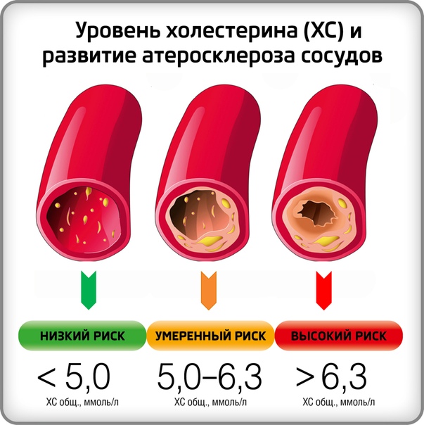 Липидный спектр что это такое