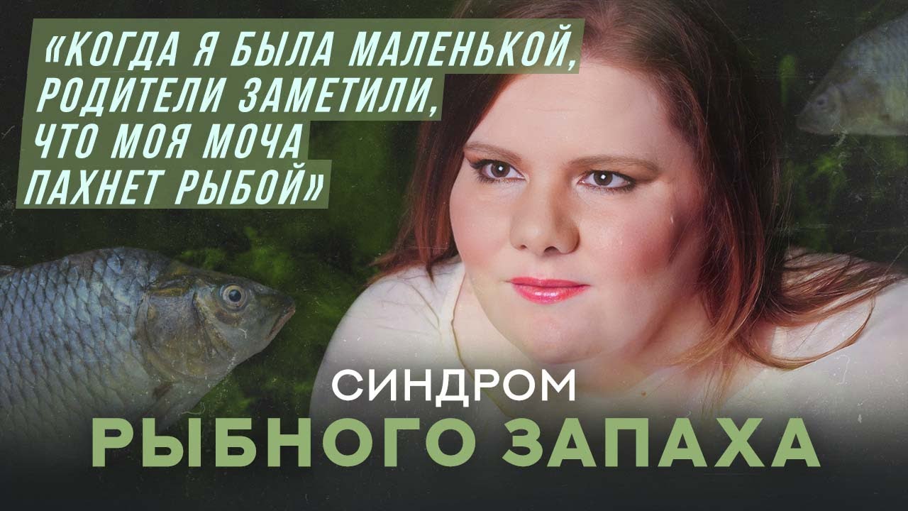 Моча пахнет рыбой у мужчин
