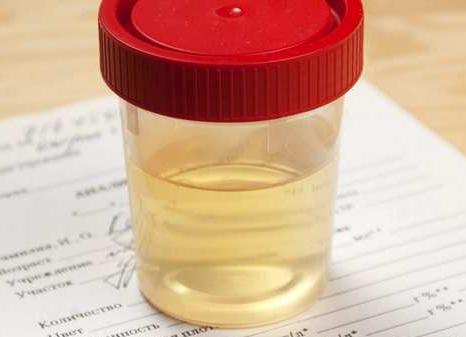 Мочи для анализа сколько