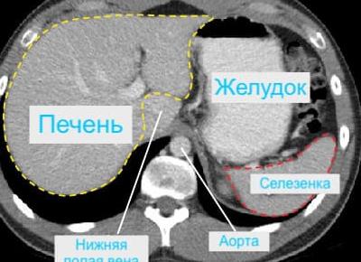Кт желудка что показывает