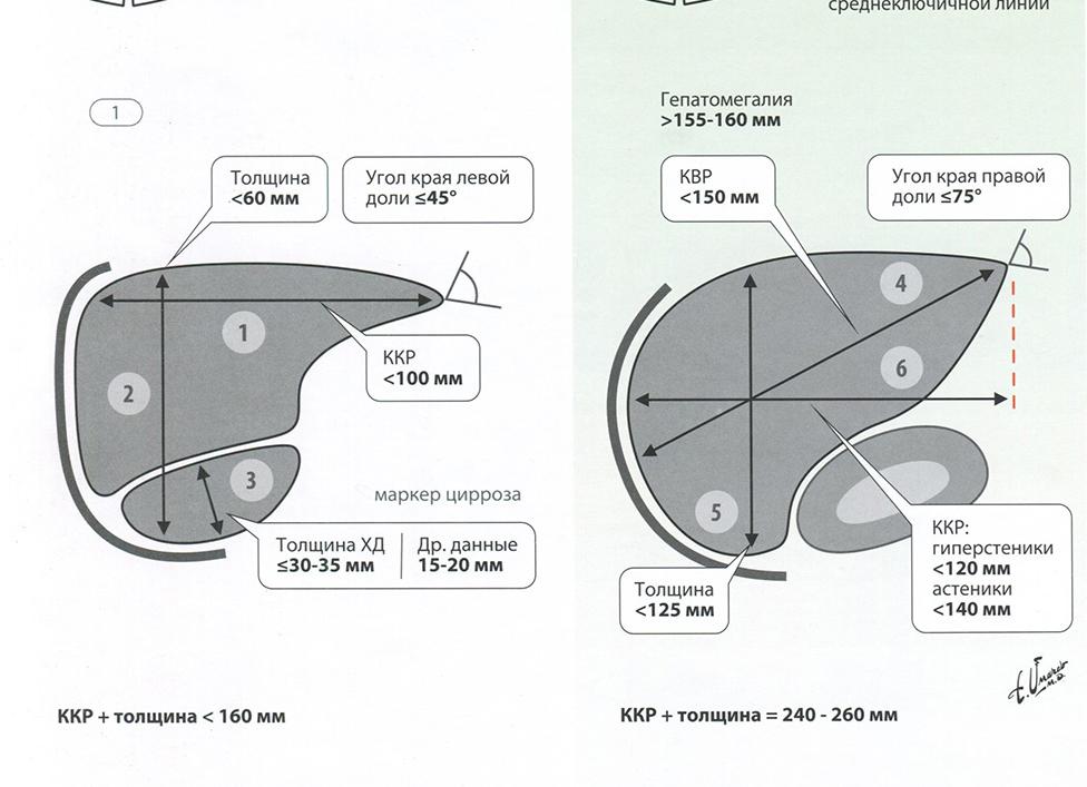 Краниокаудальный размер печени