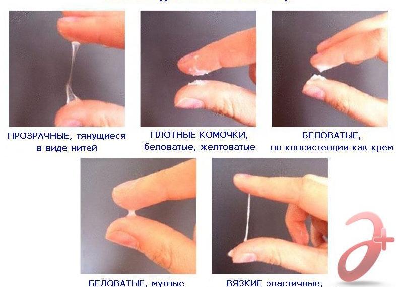 Какие нормальные выделения должны быть у женщины Какие нормальные выделения должны быть у женщины