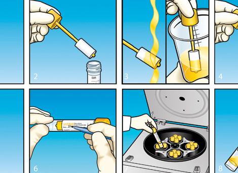 Как собрать мочу на бакпосев