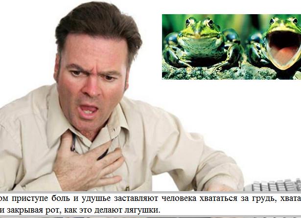 Грудная жаба болезнь