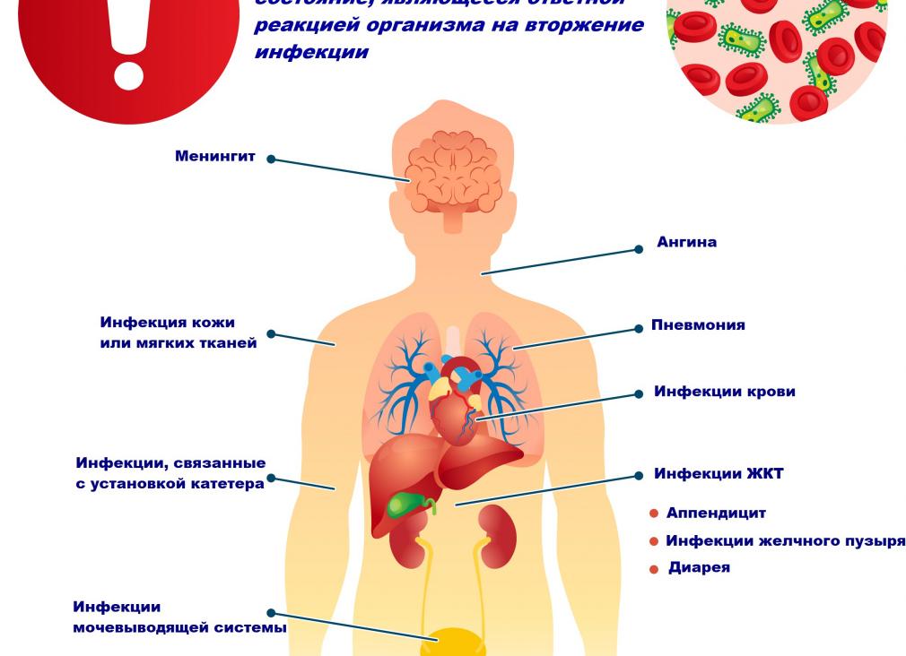 Что такое сепсис крови
