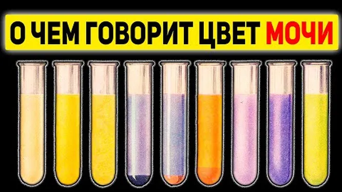 Моча лимонного цвета у женщин