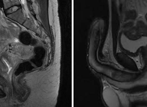 Мрт женских органов