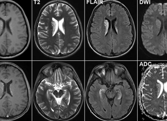 Мрт с контрастом или без в чем разница