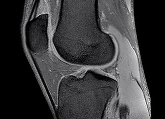 Мрт костей суставов и
