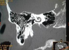 Кт уха что показывает